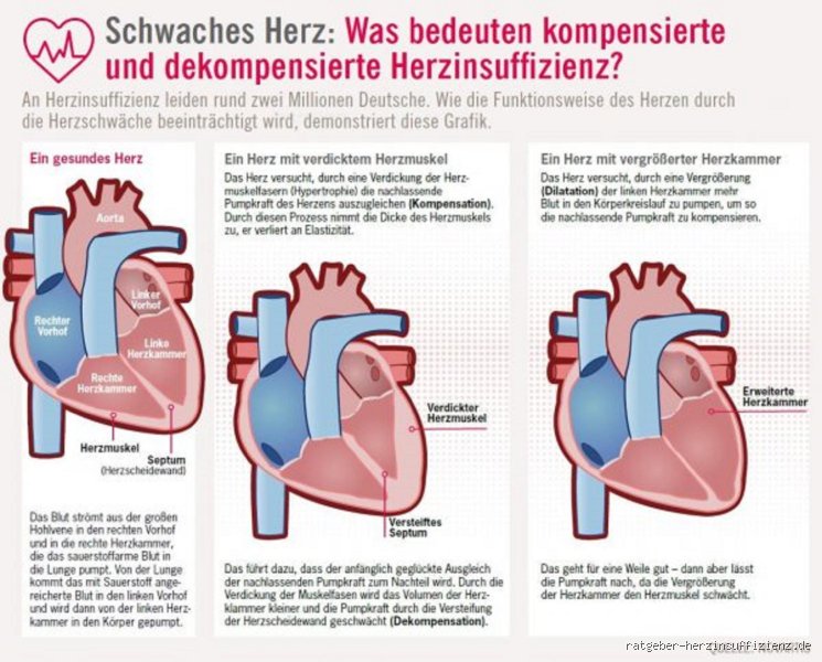 Kann sich die Herzleistung wieder verbessern?
