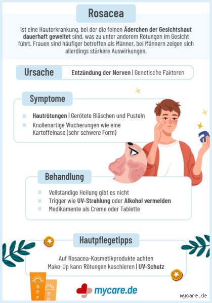 Kann sich Rosacea zurückbilden?