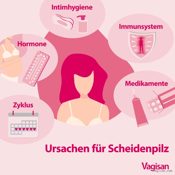 Kann Sperma Scheidenpilz verursachen?