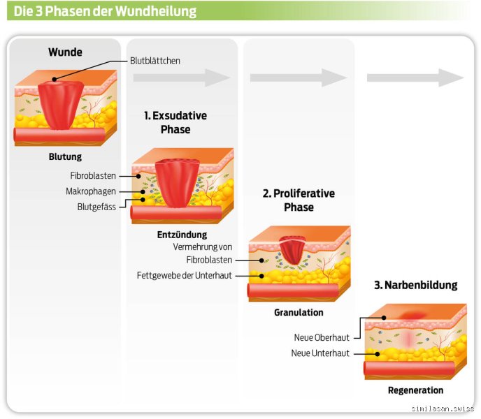 Kann Wundheilung Schmerzen verursachen?