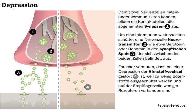 Können sich Depressionen verschlimmern? Ursachen und Verläufe im Detail