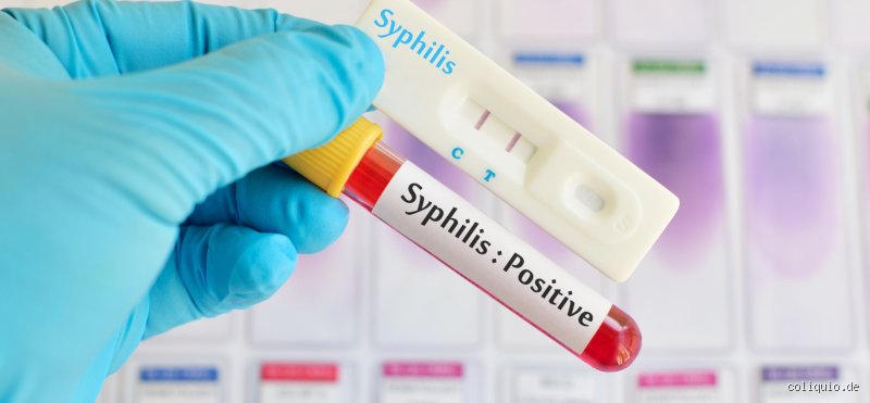 Wann sollte man auf Syphilis testen? Ein Leitfaden zu Zeitpunkten und Symptomen