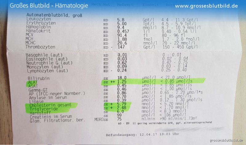Wann zahlt die Krankenkasse ein grosses Blutbild? Alles, was du wissen musst