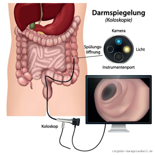 Warum dieses eine, unscheinbare Handtuch bei der Darmspiegelung wirklich wichtig ist