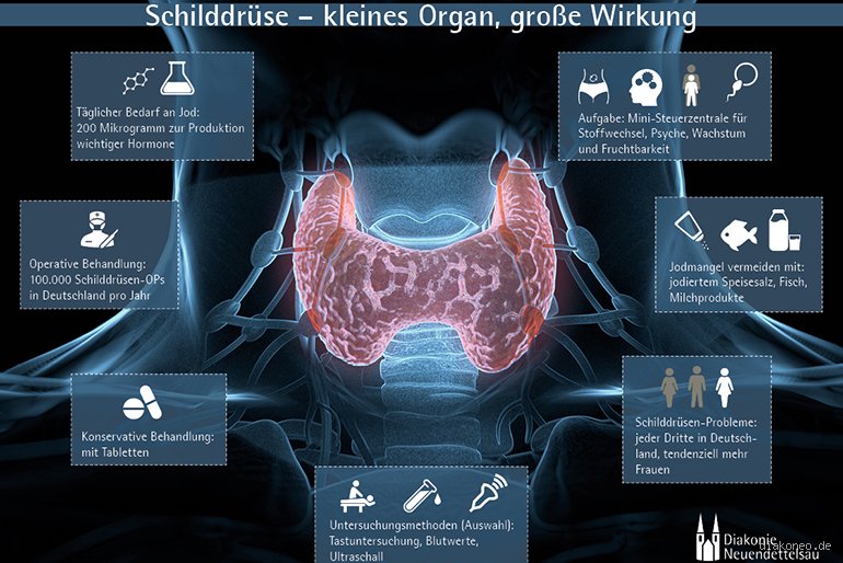 Warum erkrankt man an der Schilddrüse?