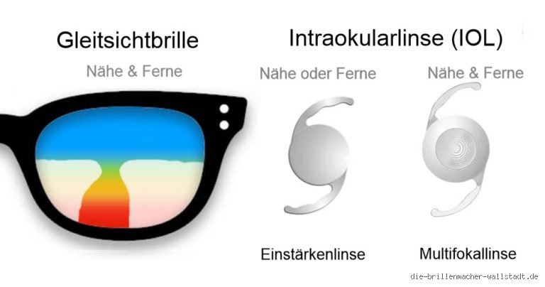 Warum Gleitsichtbrille nach Grauer Star OP?