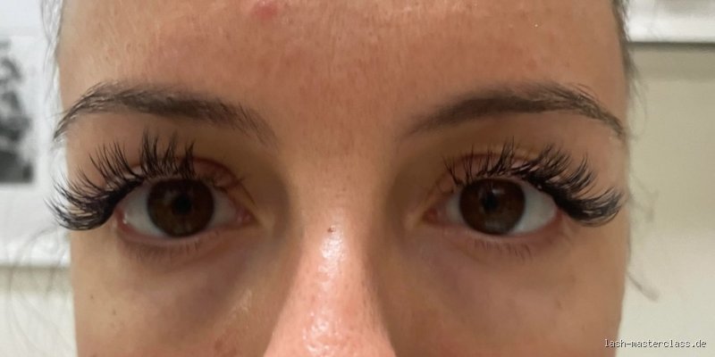 Warum juckt mein Wimpernkranz? Ursachen, Diagnose und effektive Hilfe