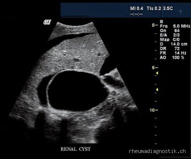 Warum nicht Rauchen vor Bauchultraschall? Die überraschenden Gründe für den leeren Magen