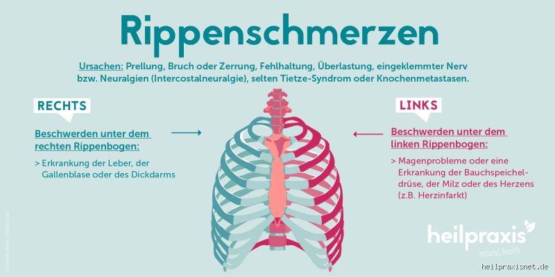 Warum tun die Rippen unter der Brust weh? Ursachen und Diagnose