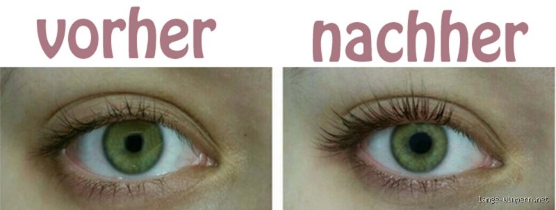 Warum wachsen Wimpern nicht weiter?