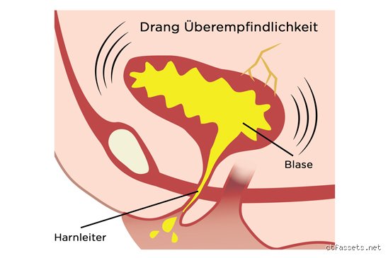 Was bedeutet die Blase weint: Hintergründe, Symptome und warum Urologen bei diesem Phänomen hellhörig werden