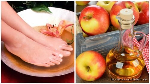 Was bringt ein Fußbad mit Essig wirklich? Zwischen Omas Hausmittel-Tricks und der modernen Wissenschaft hinter der Säure