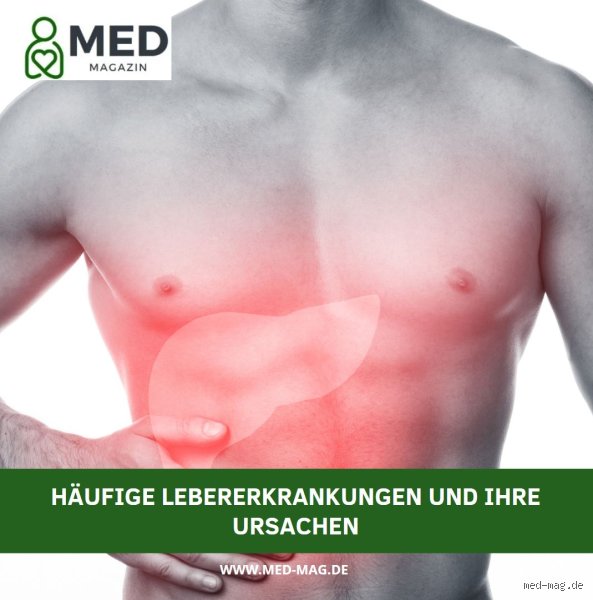 Was deutet auf eine Lebererkrankung hin? Symptome und Anzeichen, die du kennen solltest