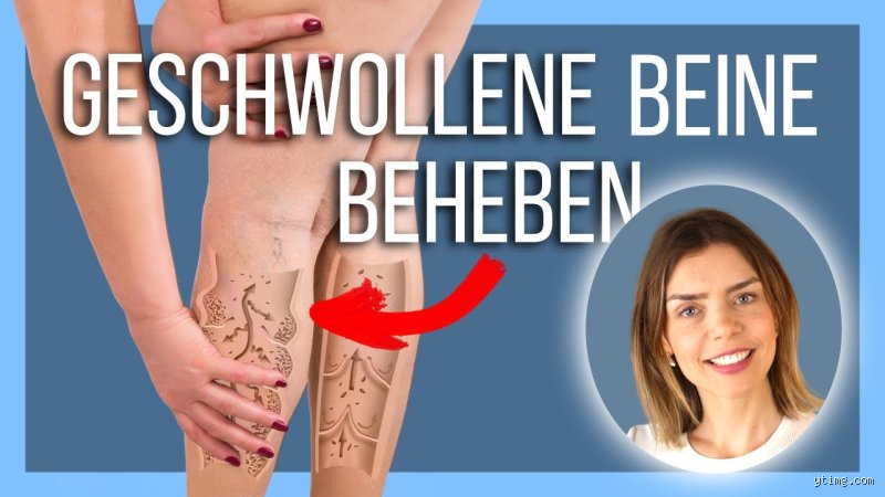 Was hilft schnell gegen Ödeme? Praktische Tipps aus Erfahrung