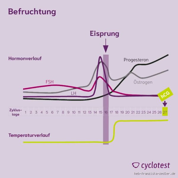 Was ist wenn der Östrogenspiegel zu hoch ist? Symptome, Ursachen und Lösungen