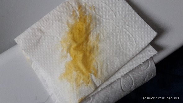 Alarmstufe Gelb? Was gelber Durchfall wirklich bedeutet!