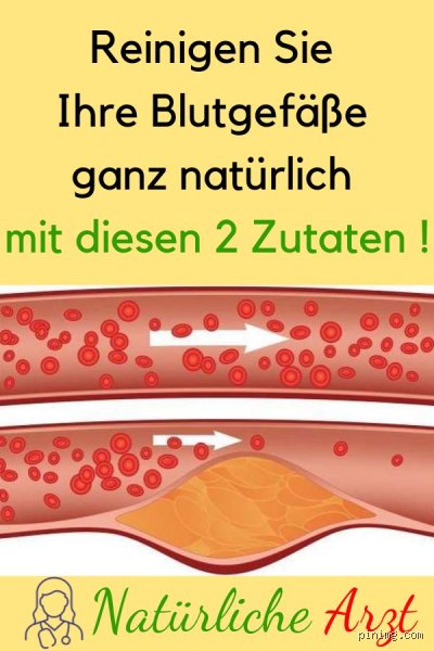 Was kann Blutgefäße reinigen? Expertenratgeber zu effektiven Methoden