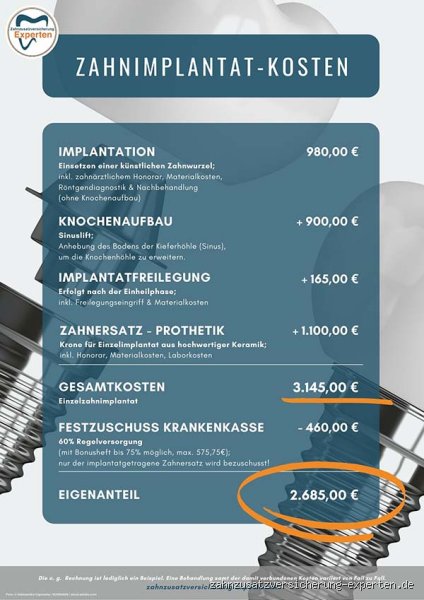 Was kostet ein Zahnimplantat 2023?