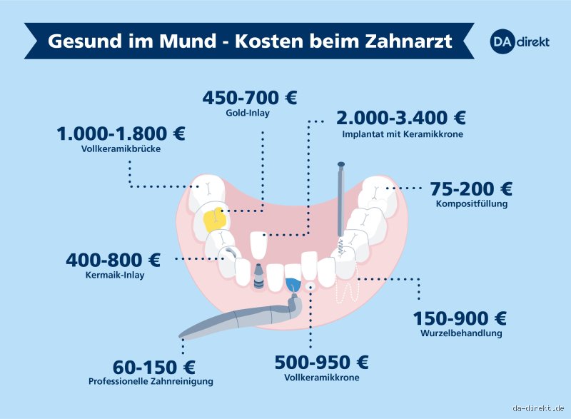 Was kostet eine Füllung beim Zahnarzt ohne Versicherung wirklich? Eine ehrliche Übersicht
