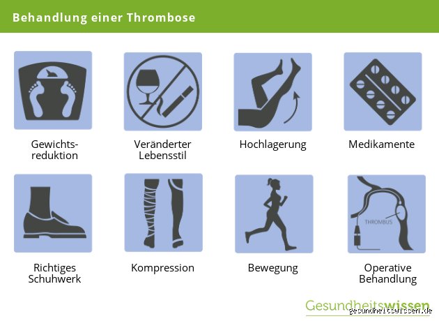 Was macht man im Krankenhaus bei Thrombose? Ein ehrlicher Blick auf Diagnose und Behandlung