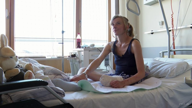Was passiert mit einem amputierten Bein? Zwischen Pathologie, Ethik und dem harten Weg zurück ins Leben