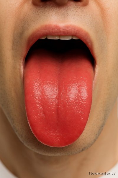 Was sagt eine rote Zunge aus?