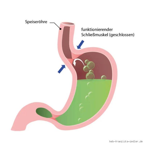 Was trinken bei gereizter Speiseröhre?