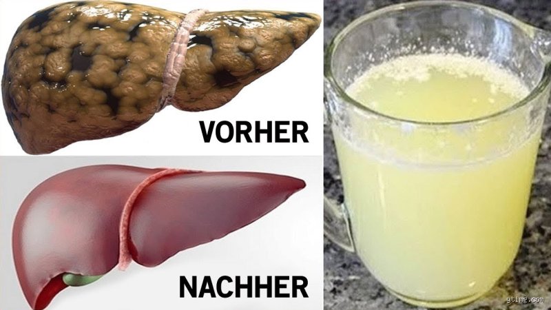 Was trinken bei schlechten Leberwerten?