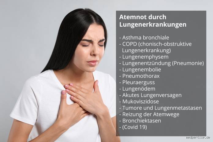 Wenn die Luft knapp wird: Was tun bei Atemnot durch Reflux wirklich hilft