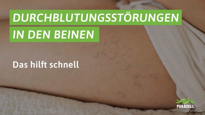 Was tun bei schlechter Durchblutung in den Beinen? Tipps aus der Erfahrung