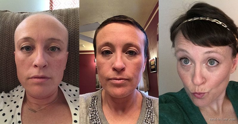 Was tun damit Haare bei Chemo nicht ausfallen? Strategien und medizinische Fakten