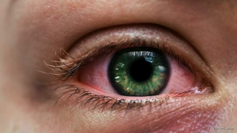 Was tun wenn man sich die Augen verbrannt hat? Schnelle Hilfe und langfristige Strategien