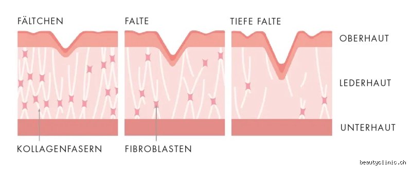 Was verstärkt Falten?