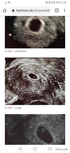 Welche Krankheiten sieht man nicht im Ultraschall? Ein ehrlicher Blick auf die Grenzen der Diagnostik