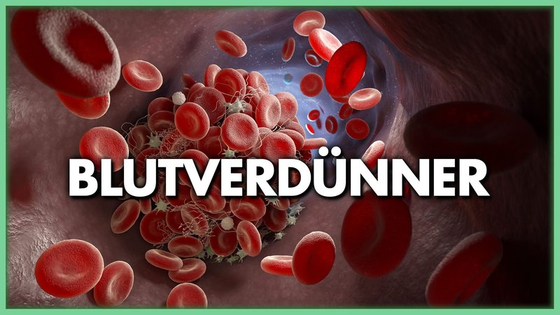 Wunderschne Welche Schmerzmittel Bei Blutverdnner Fotos