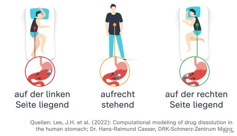 Welche Schmerztablette bei Darmschmerzen?