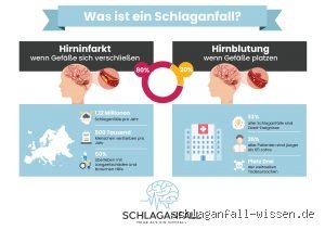 Welche Seite zuerst waschen bei Schlaganfall? Strategien für die therapeutische Körperpflege