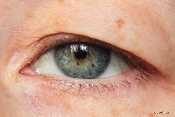 Welches Hausmittel hilft gegen Schlupflider wirklich und wo zieht die Naturheilkunde ihre klaren Grenzen?