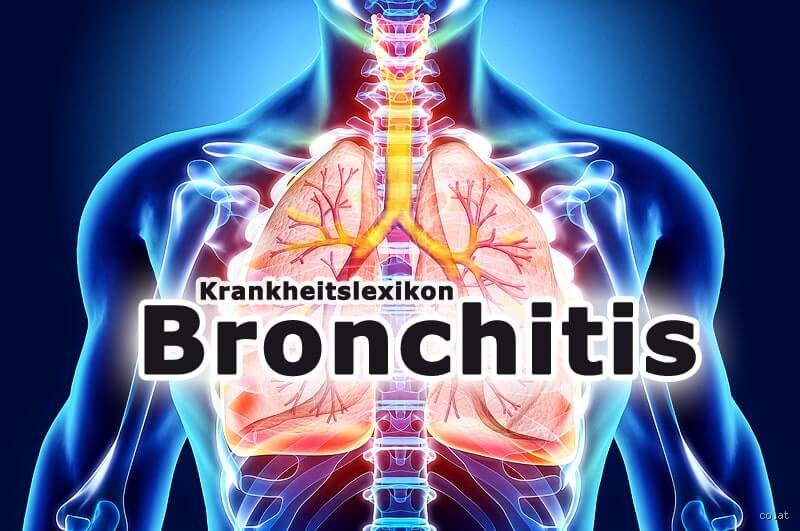 Wie äußert sich eine verschleppte Bronchitis? Symptome, Gefahren und Behandlungswege