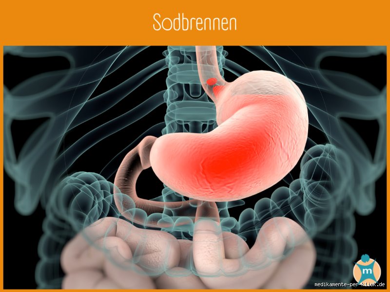 Sodbrennen effektiv behandeln: Was wirklich hilft und wann Sie zum Arzt sollten