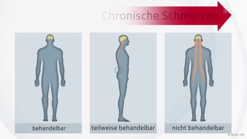 Wie bekommt man chronische Schmerzen diagnostiziert?