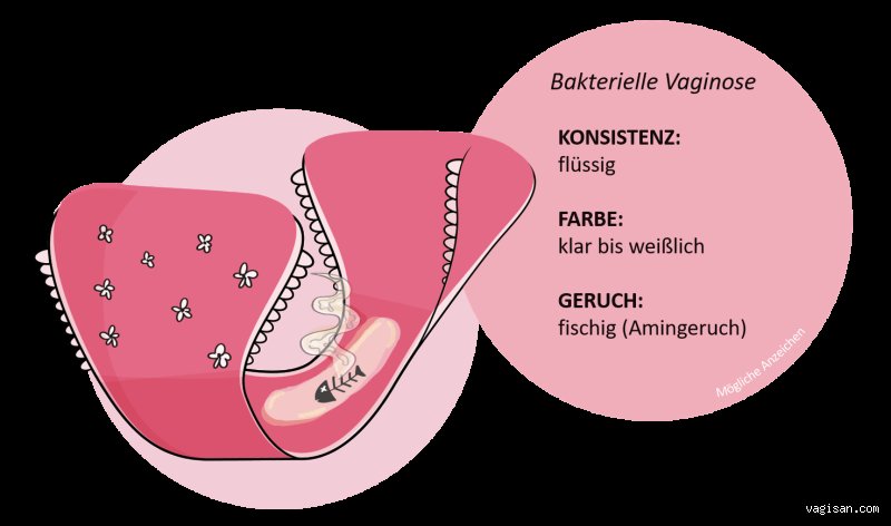 Wie bekommt man den Geruch aus der Scheide weg?