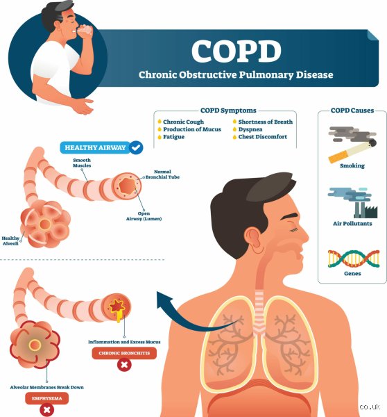 Wie erkenne ich, ob diese ständige Kurzatmigkeit wirklich COPD ist? Die ersten Alarmsignale