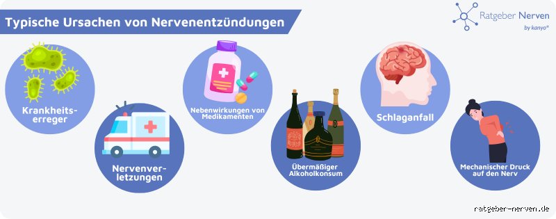 Wie fängt eine Nervenentzündung an und woran man die ersten heimtückischen Anzeichen erkennt
