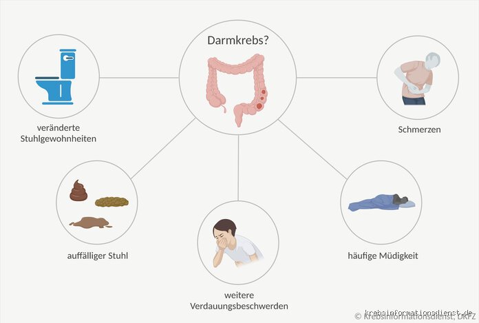 Wie fühlen sich Schmerzen bei Darmkrebs an?