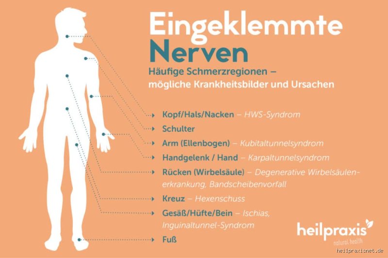 Wie fühlt sich ein eingeklemmter Nerv in der Brust an?