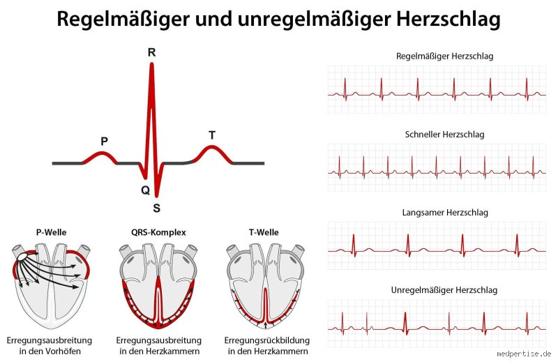 Wie kann ich objektiv feststellen, ob ich Herzrhythmusstörungen habe?