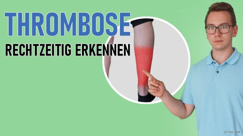 Wie kann ich testen ob ich eine Thrombose habe?