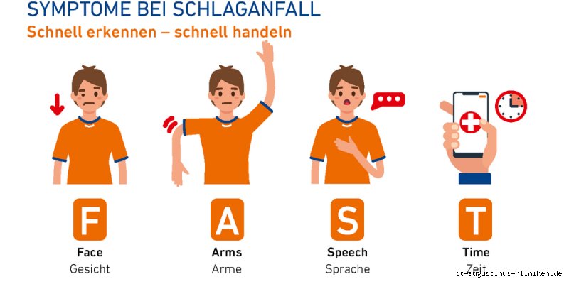 Wie kann man feststellen ob man einen Schlaganfall hatte?