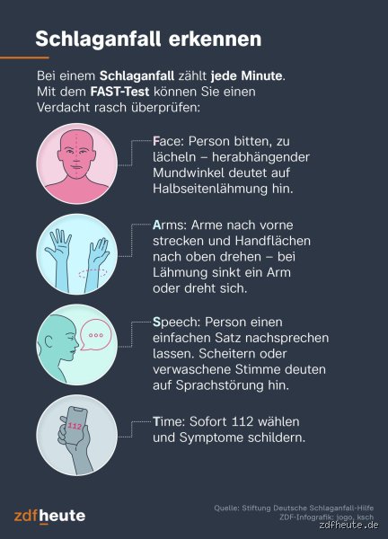 Wie lange dauert ein stiller Schlaganfall?